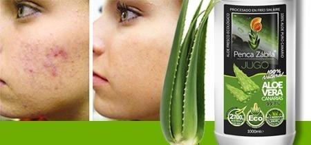 Aloe Vera Gel Skin Cream